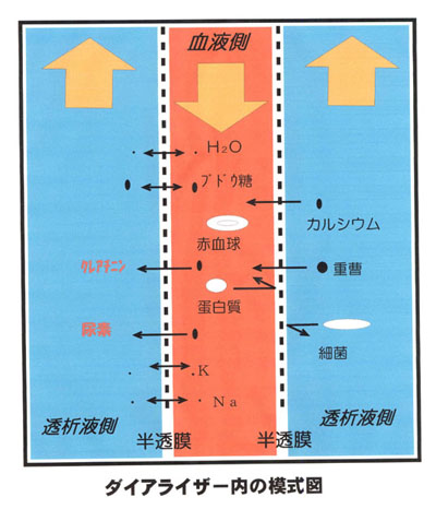 図：ダイヤライザー内の模式図